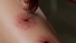 妖孽小村醫-EP9